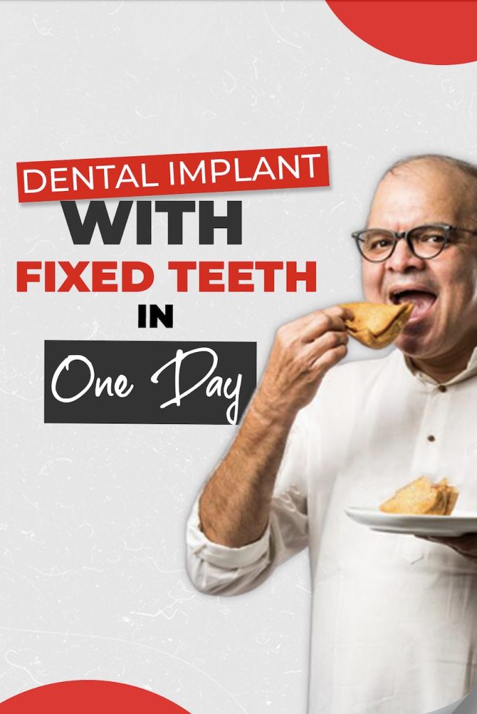 dental implant in just one day