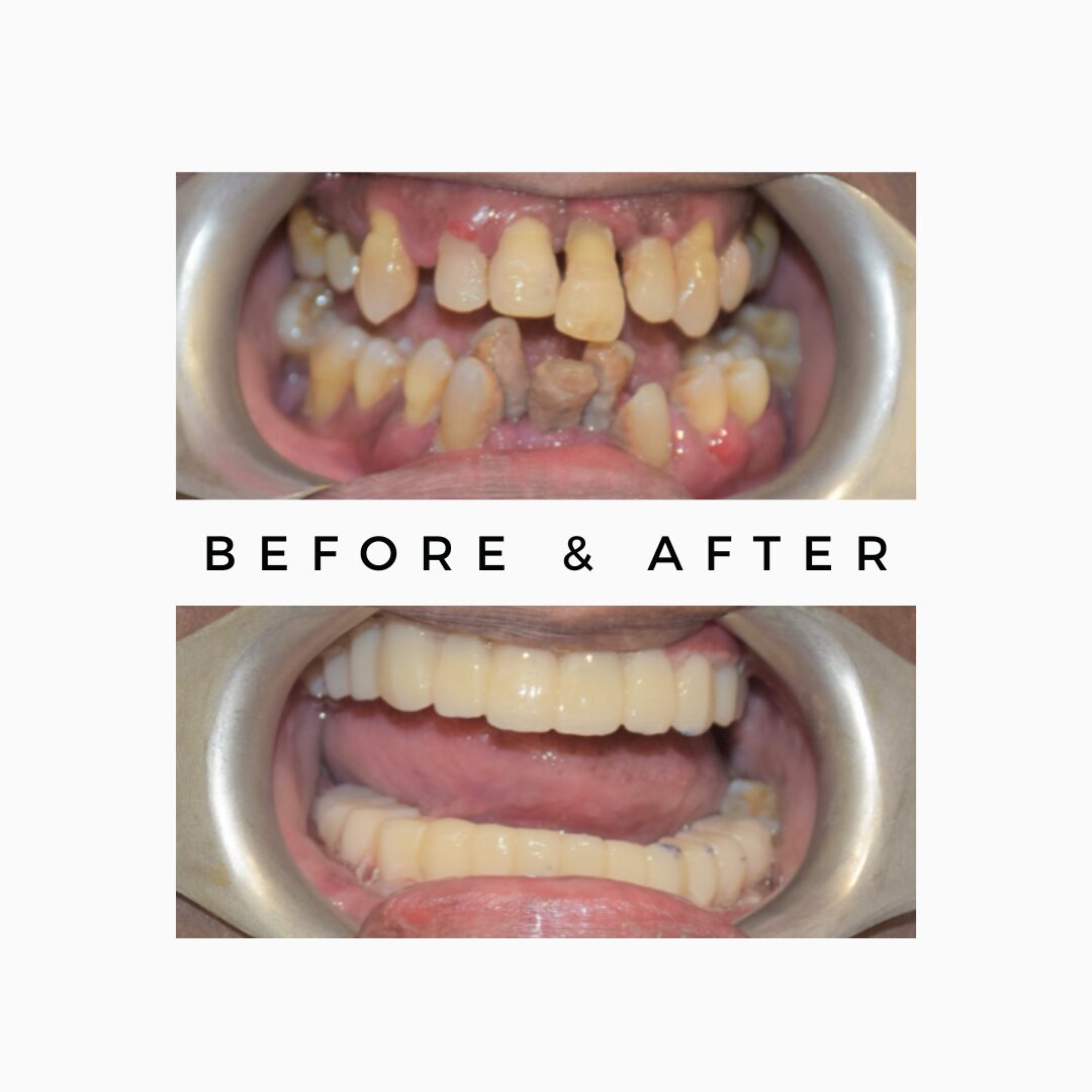 Experienced dental specialists in India