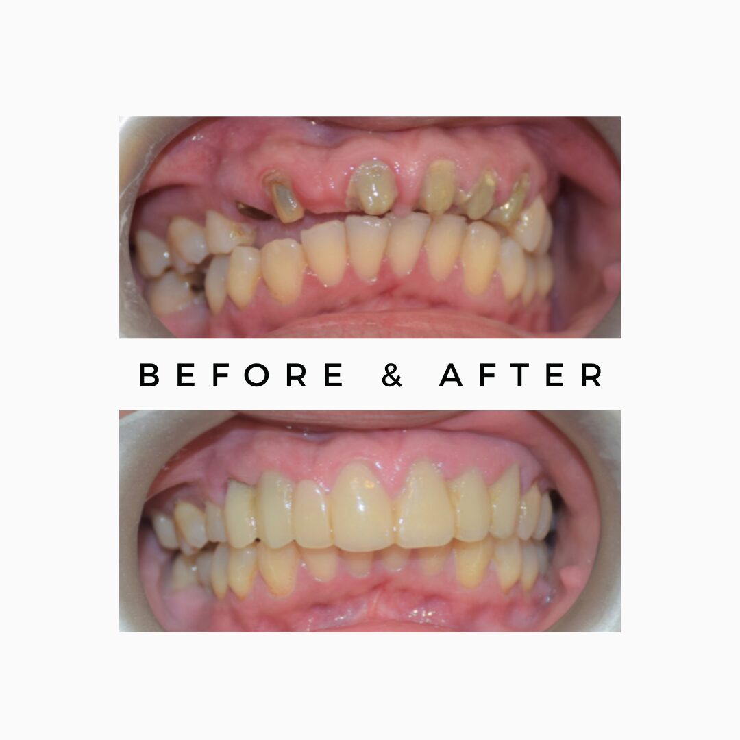 Dental\ transformation results India